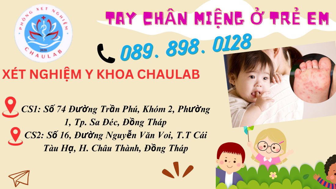 Tay chân miệng ở trẻ em